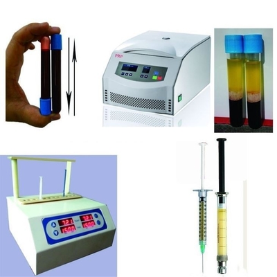 6/8x15ml Dispositivo de centrifugadora PRP portátil 0-4000rpm para hospitales de cirugía estética