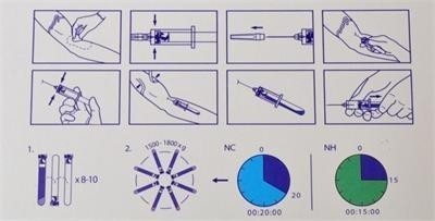 6/8x15ml Dispositivo de centrifugadora PRP portátil 0-4000rpm para hospitales de cirugía estética